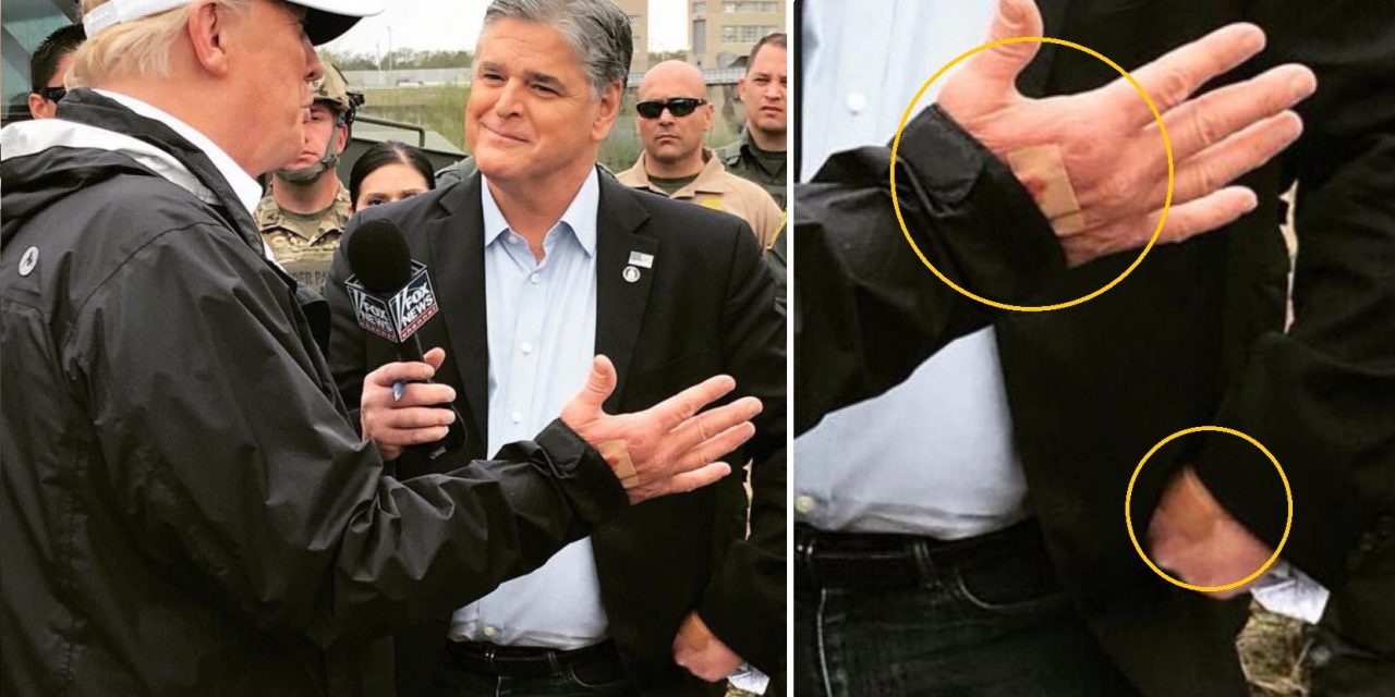 The Internet Has Questions About Mysterious Trump And Hannity Bloody Band-Aids Photo