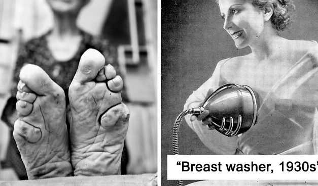 30 Unimaginable Things Women Did In The Past Just For The Sake Of ‘Beauty’