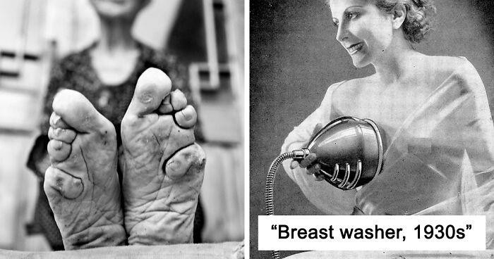 30 Unimaginable Things Women Did In The Past Just For The Sake Of ‘Beauty’